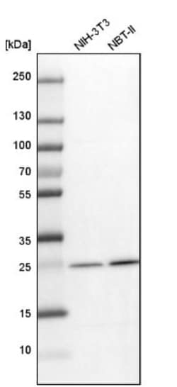 Biliverdin Reductase B/BLVRB Antibody, Novus Biologicals:Antibodies:Primary